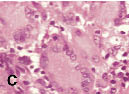 missing image file