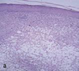 2421fig2a (kopia).jpg