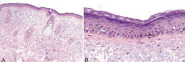 2947fig2.tif