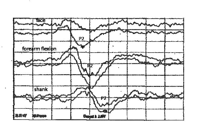 3513fig2.pdf