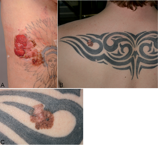 How Tattoos Work: A Fundamental Explanation - Owlcation