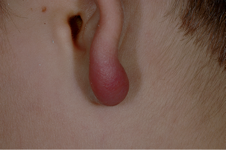 4303fig2.tif