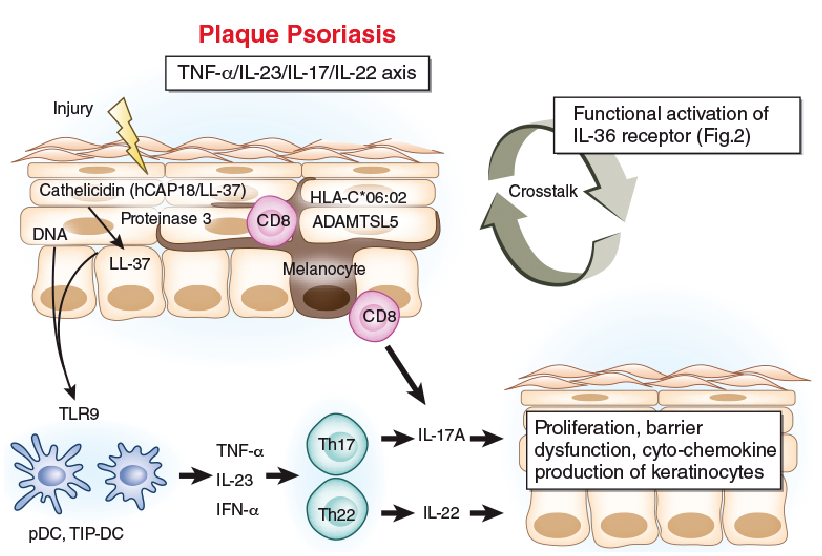 Highlighting Interleukin 36 Signalling In Plaque Psoriasis And Pustular Psoriasis Html Acta Dermato Venereologica