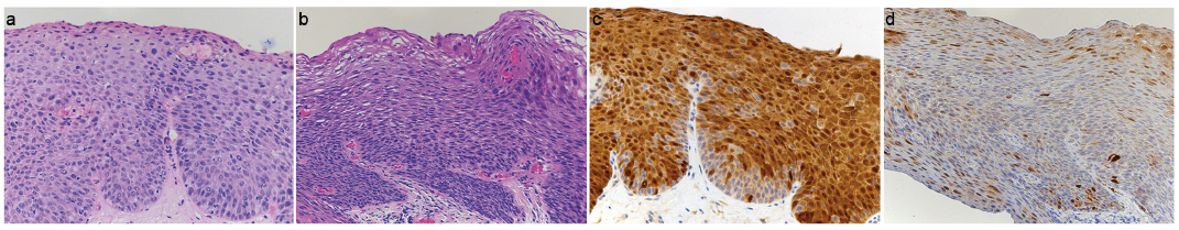 a condyloma ég emberi papilloma orvos