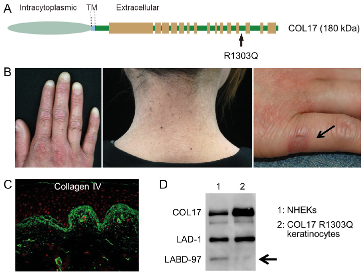 Collagen XVII Processing and Blistering Skin Diseases, HTML