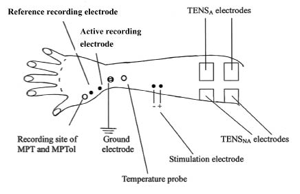 Electrode Placement For Electrical Stimulation Chart Pdf