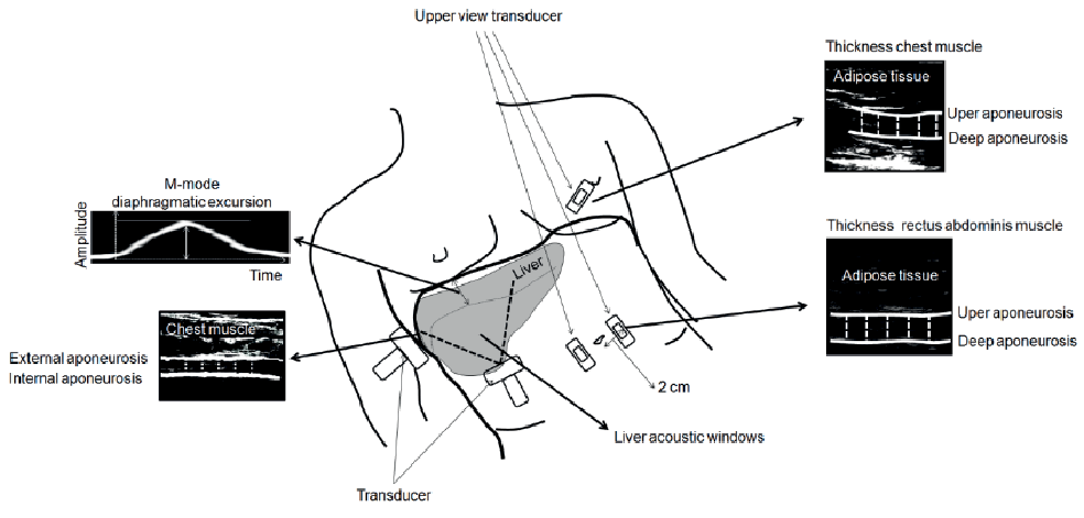 https://www.medicaljournals.se/jrm/html-editor/html-img/2252/2252_2308.png