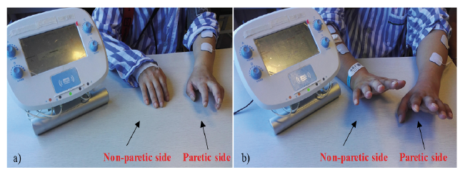 https://www.medicaljournals.se/jrm/html-editor/html-img/2488/2488_12698.png